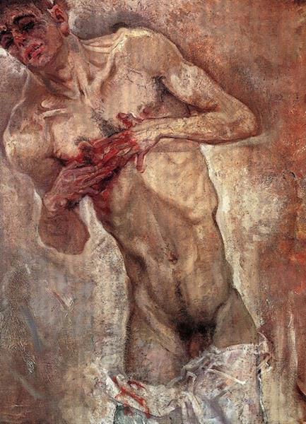 Bleeding, 1911 - Max Oppenheimer
